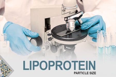 Lipoprotein Particle Size